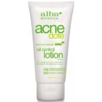 Acne Oil Control Lotion 57g Alba